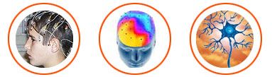 Tres circulos con imágenes dentro, la primera muestra un joven al que se le realiza un escaner EGG, la segunda muestra una representación con colores de las zonas del cerebro y la tercera unas neuronas